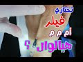 فيلر مع هيالوال | دكتورة هند ابراهيم