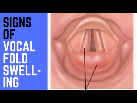 Video: Swelling Of The Vocal Cords