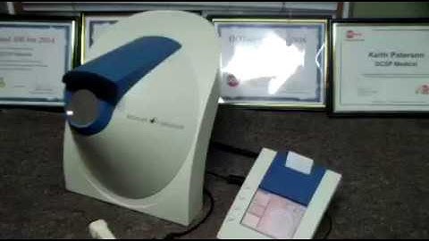 Oculus Easyfield Vision Screen Visual Field Analyzer