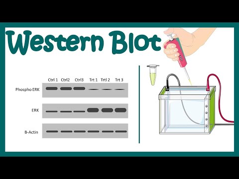 Видео: Разлика между Elisa и Western Blot