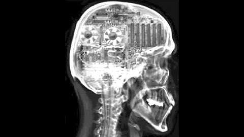 Tra:Fo - Unconscious DNB Mix (Jubei, Skeptical, Dub Phizix, Flare, Amoss, Enei, Subtitles, ...)