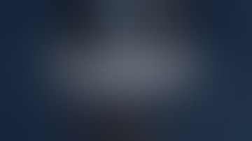 Unicondylar Knee Replacement Explained Step-By-Step