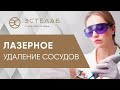 ⭐️ Лазерная коагуляция «звездочек», ангиом, постакне на коже лица. Лазерная коагуляция кожи лица.12+