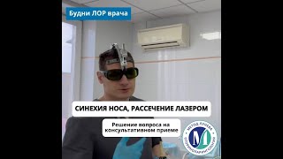 Рассечение синехии полости носа лазером