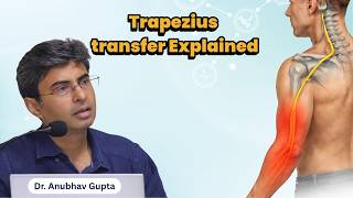 Trapezius Transfer Explained | Shoulder Abduction Reconstruction in Brachial Plexus Injury