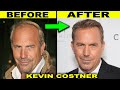 Kevin Costner 2022 Shocking Transformation – Yellowstone Actor Before and After Hair Transplant