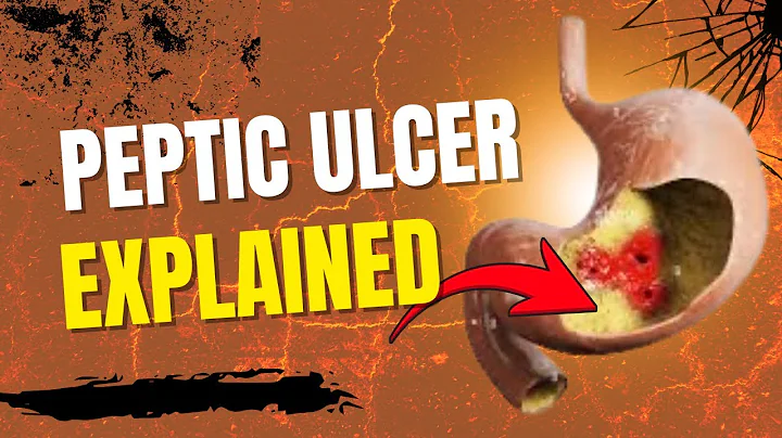 Peptic Ulcer Disease: Nursing Notes in 10 Minutes