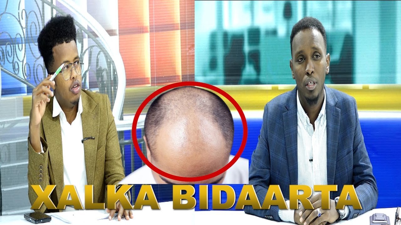 Barnaamijia Baraarug ee Dhalinyarada--Bidaarta iyo Dhalinyarad Maxaa kala heysto?Waxaa marti ku ah