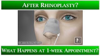 1st Appointment after Rhinoplasty -1 What happens?... stitches, taping nose, anti-swelling medicine