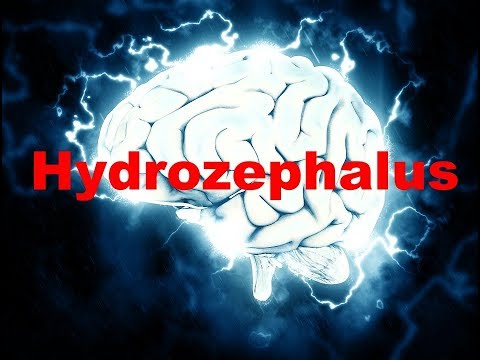 Hydrozephalus / #Neurologie 4