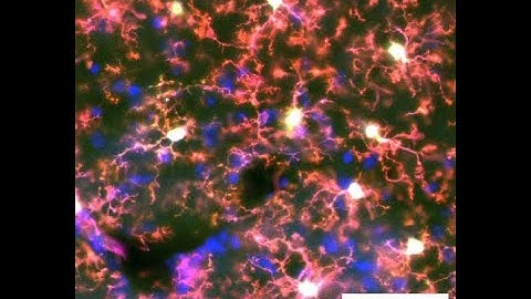 Microglia Morphology Analysis