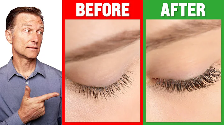 How to Grow Long Thick Eyelashes QUICKLY! - Dr. Berg - DayDayNews