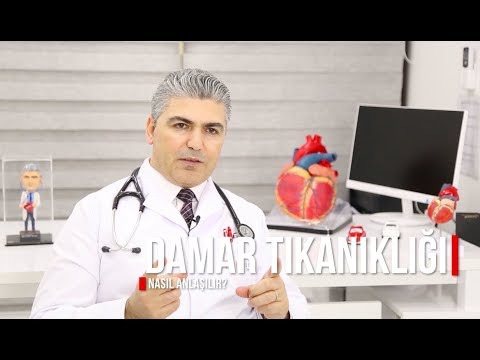 Kalp Damar Tıkanıklığı Nasıl Anlaşılır? EKG, EKO, Efor Testi, Kalp Sintigrafisi, Anjiyo