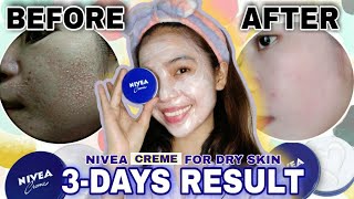 I USED NIVEA CREME TO TREAT MY DRY SKIN | SEE THE RESULT 😱 (WORTH TO TRY!!) | Celine C. screenshot 5