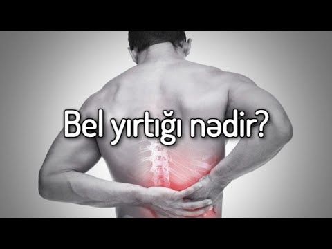 Video: Bel ağrısı ilə səyahət etməyin 3 yolu