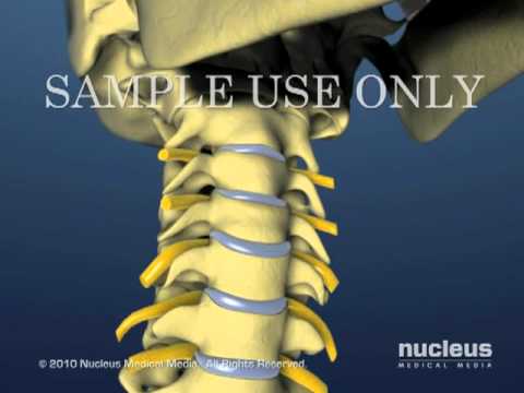 Neck Movement - Lateral Flexion - YouTube