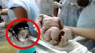Top 10 Pessoas que Sobreviveram ao Impossível