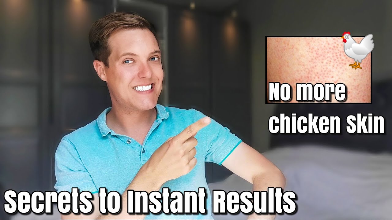 Get rid of KERATOSIS PILARIS ( KP ) FAST Results in 4 weeks full