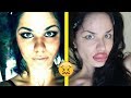Before and After Plastic Surgery Extremes That Will Make You Cringe