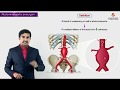 Abdominal aortic aneurysm : Usmle step 1 - Causes , Signs & symptoms , diagnosis , treatment