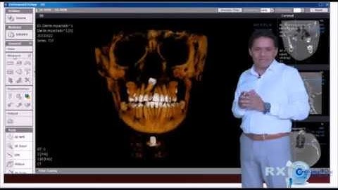 OnDemand3D: Modulo 3D