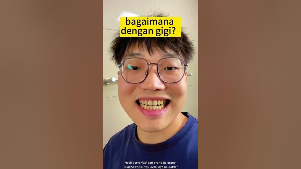 cara memutihkan gigi kuning