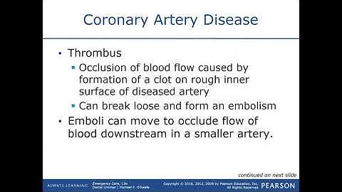 Cardiac Emergencies Lecture 2 / EMT MADE EASY