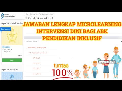 Video: Cabaran Dalam Memahami Sindrom Sjögren - Pemahaman Yang Lebih Baik Ke Dalam Patogenesis Menjana Harapan Untuk Terapi Inovatif?