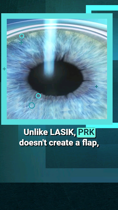 PRK Surgery: The BEST Option for Thin Corneas?