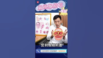 你也有這個壞習慣嗎？揭開扁桃腺結石罪魁禍首！#扁桃腺 #扁桃腺結石 #扁桃腺炎  #耳鼻喉頭頸部 #光田醫院 #黃聖凱醫師