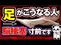 【見逃すと突然倒れる】絶対に知っておいてほしい!脳梗塞の足の危険サインを紹介(脳梗塞 コレステロール)