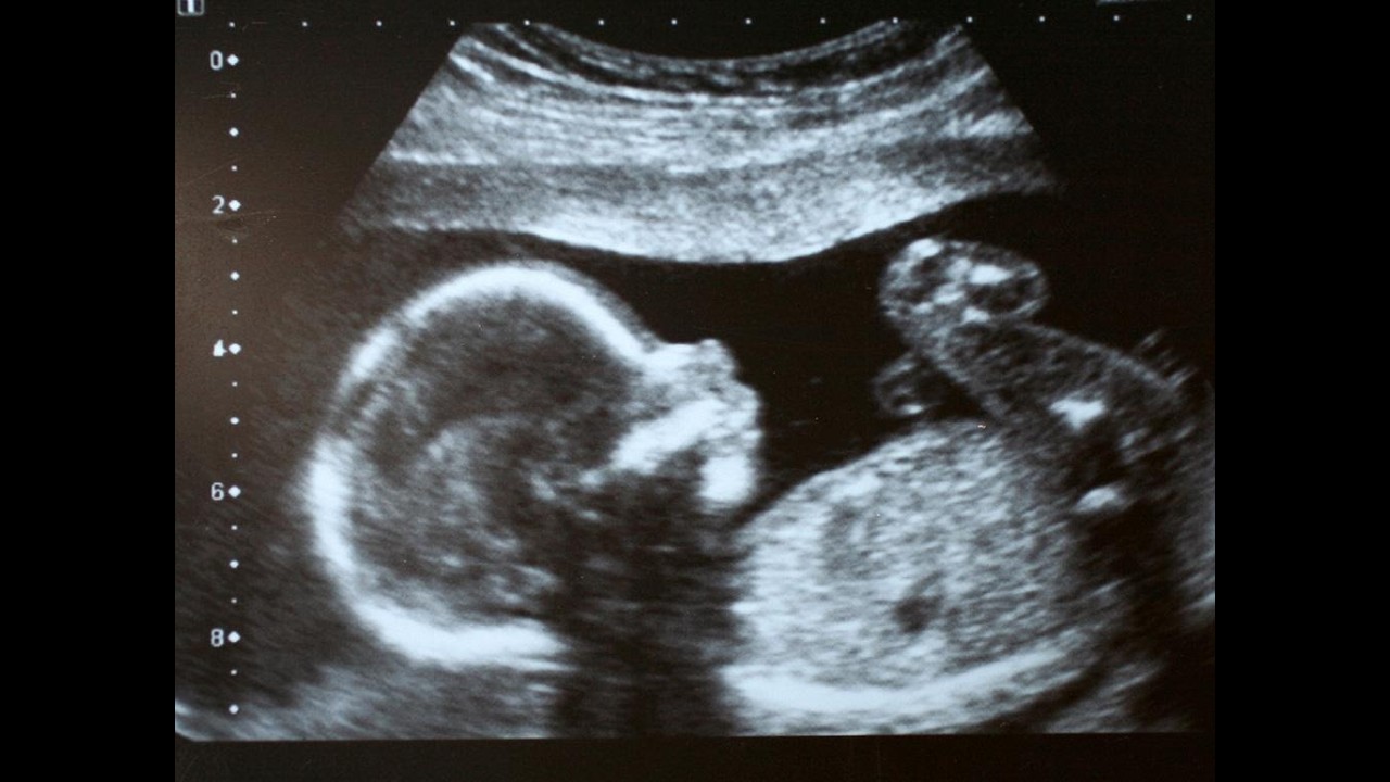 To make a donation, visit our website at https://firstchurchofmilford.org/giving/

10:00 AM Worship service on Sunday is live-streamed on LocalLive TV 
https://3850-first-united-church-of-christ.livecontrol.tv/

If you would like to donate and help with our online live-streaming costs, you can mail your check to First United Church of Christ, 34 W. Main St, Milford, CT 06460.  Please note "for live-streaming" in memo line.  Thank you!
 
Music Reprinted, Performed and Used with Permission Under:  
CCLI 4483136, One- License A-134621, 
WorshipCast and PerformMusic 14088