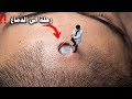 رحلة الى الدماغ مع الدكتور عاصم mp3