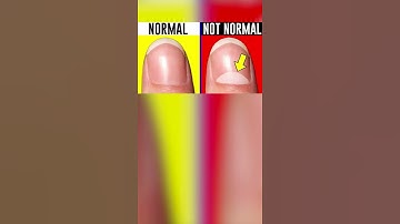 Thumbnail of How RARE Is Your Body?!