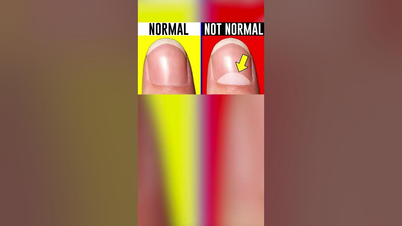 How RARE Is Your Body?!