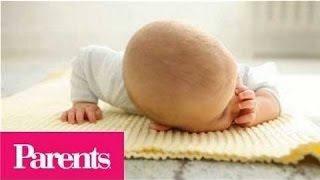 Watch as Parents Magazine shows when to worry about cradle cap! Seborrhoeic dermatitis, also known as cradle cap, is extremely 