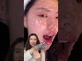 как убрать акне и постакне дома смотри в моем телеграм - mariiamilli #акне #дерматолог #уходзакожей