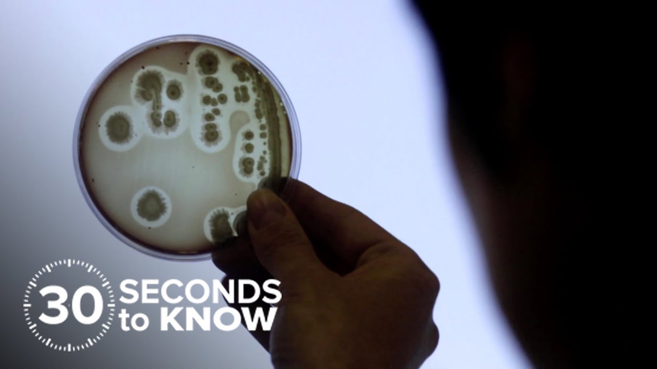 how can you catch e coli how can you catch e coli