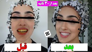 سفید کردن دندان در یک دقیقه |داشتن دندان سفید در فیلم و عکس screenshot 4