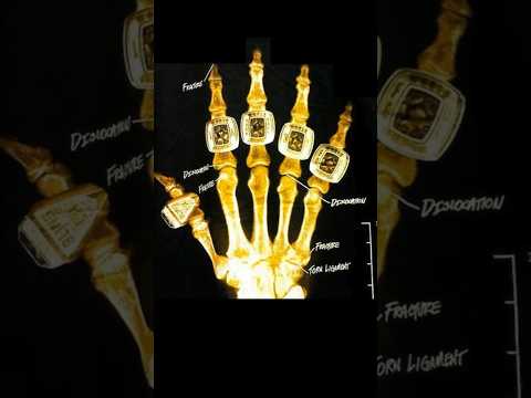 Hand ANATOMY of a 5-time Champion | Kobe Bryant Tribute 01/26/24