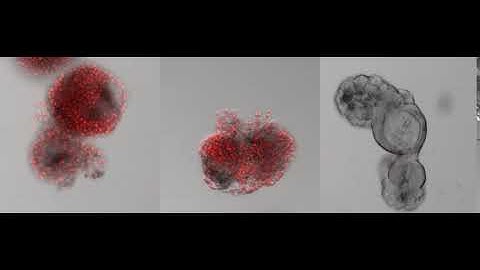 Cell Death in Intestinal Epithelial Organoids / Cell Reports, December 19, 2017 (Vol. 21, Issue 12)