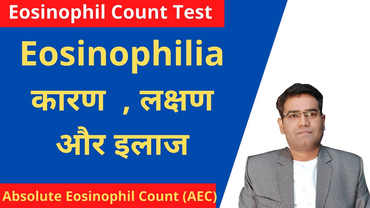 Eosinophilia Blood Test in Hindi, Causes & Treatment of eosinophil count high (EOSINOPHILIA