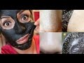 MASCARILLA DE CARBON - ELIMINA TUS PUNTOS NEGROS