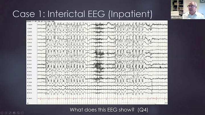 AES Professors Rounds: Adult Epilepsy Case Studies
