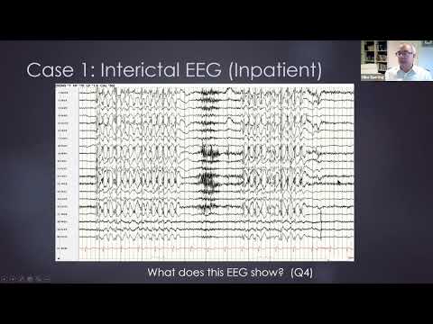 AES Professors Rounds: Adult Epilepsy Case Studies
