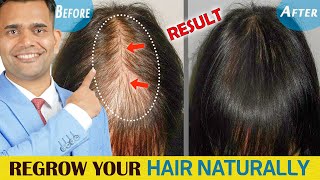 How To Stop Hair fall and Regrow Your Hair Naturally - Dr. Vivek Joshi