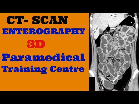 CT ENTEROGRAPHY