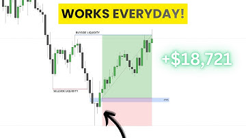 Stupid Simple Gold Trading Strategy That Works Everyday!