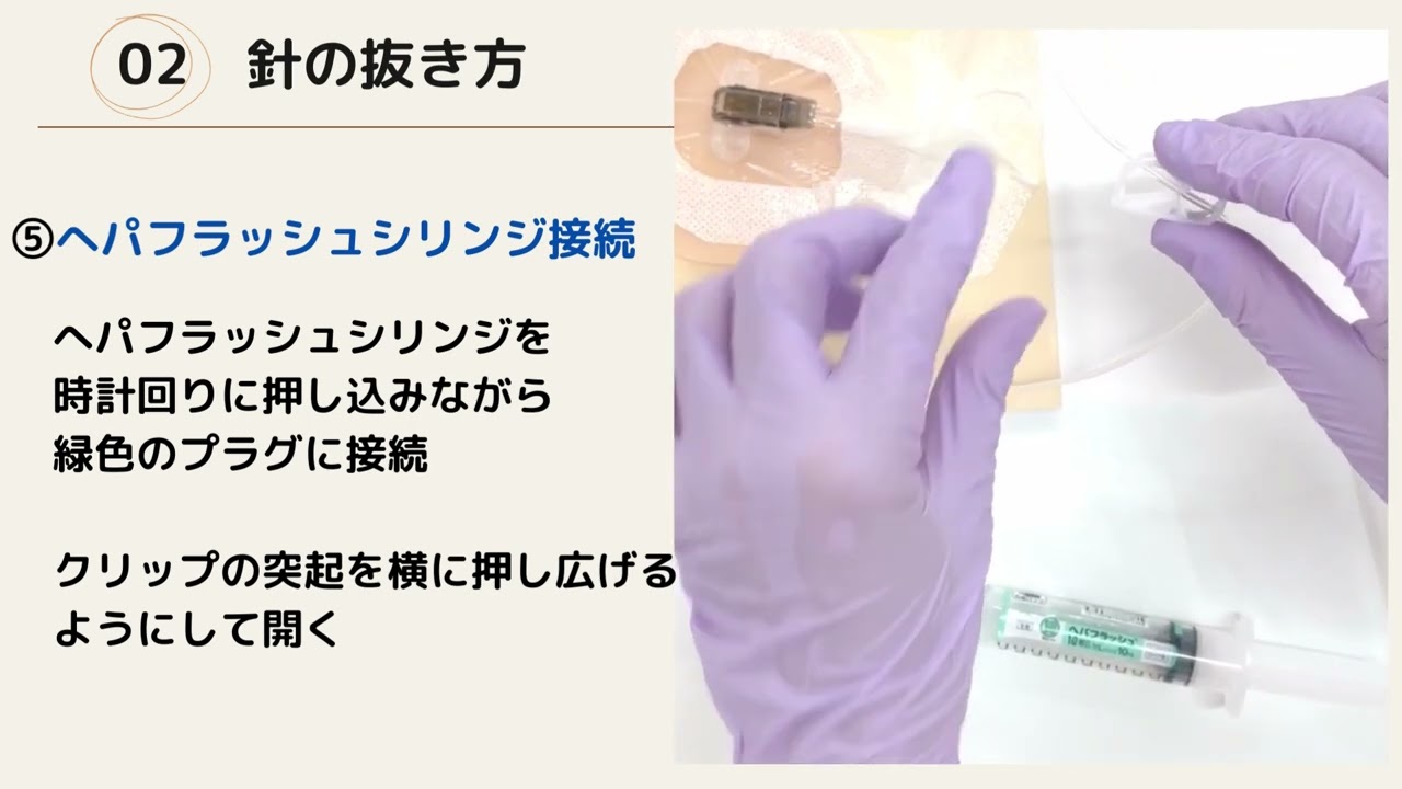 CVポート　自己抜針手順