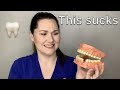 The WORST parts about dental assisting (the TRUTH)